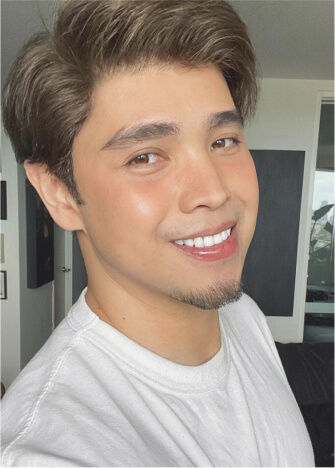 Opalescence Teeth Whitening Customer